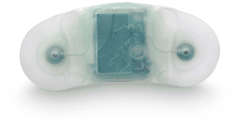 Image: The Zio Patch long-term cardiac rhythm monitor (Photo courtesy of iRhythm Technologies).